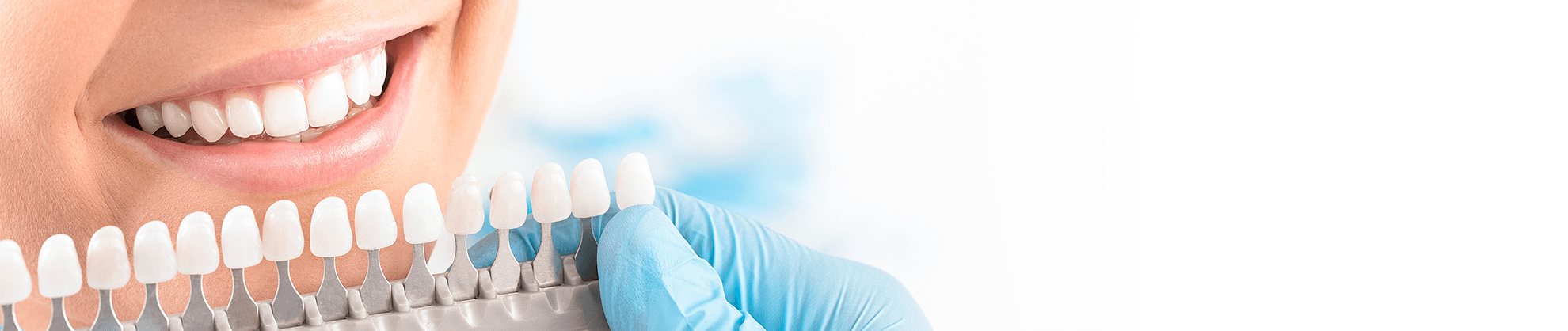 Veneers in Beaverton, Oregon